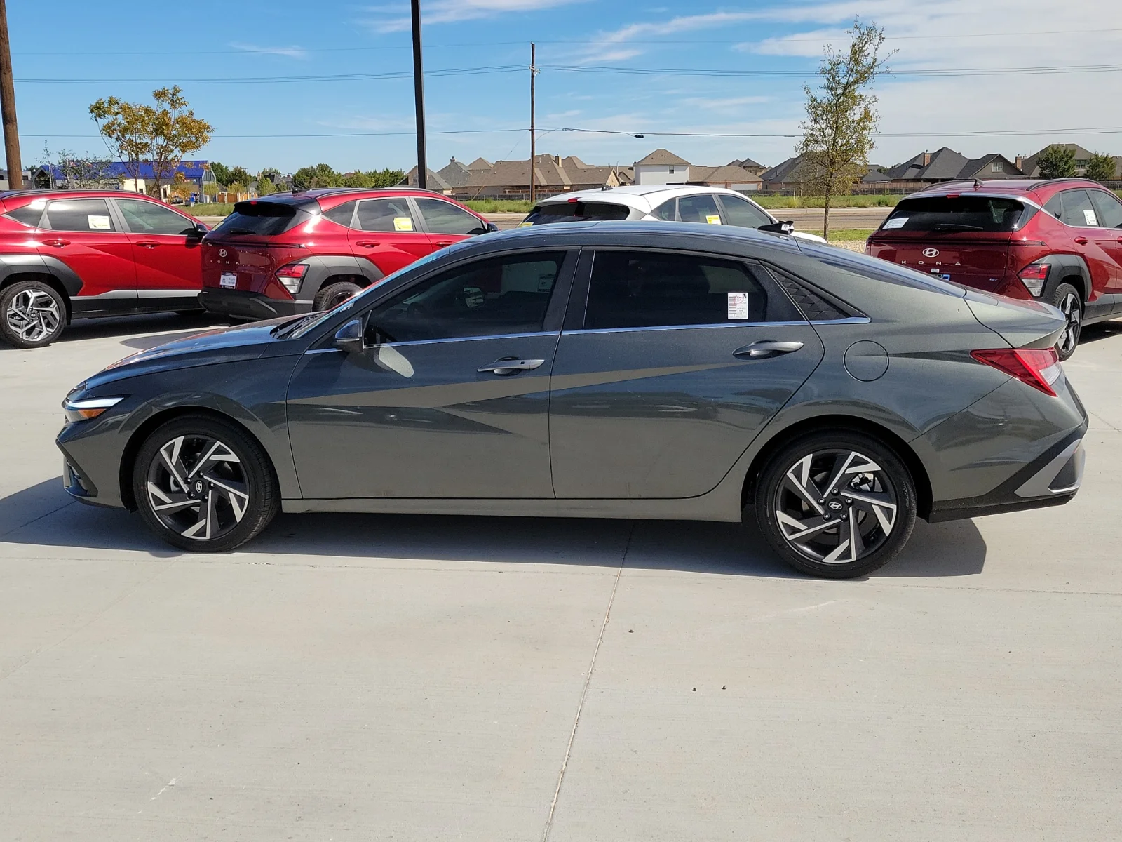 New 2026 Amazon Gray Hyundai Limited (IVT) 4dr Sedan image 2