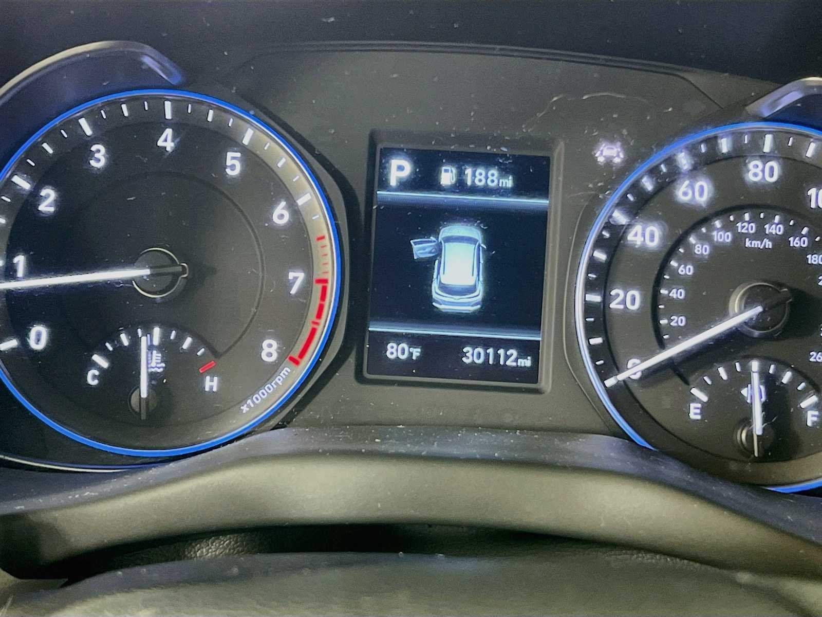 Used 2020 Ultra Black Hyundai SE image 12