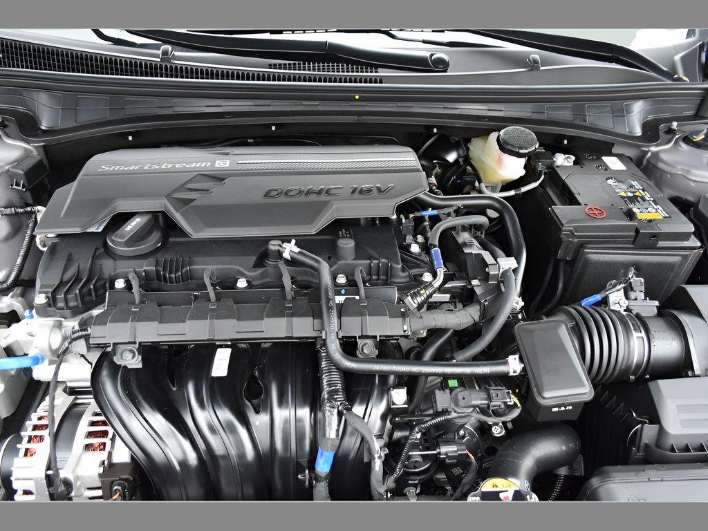 New 2026 Fluid Metal Hyundai SEL Sport image 9
