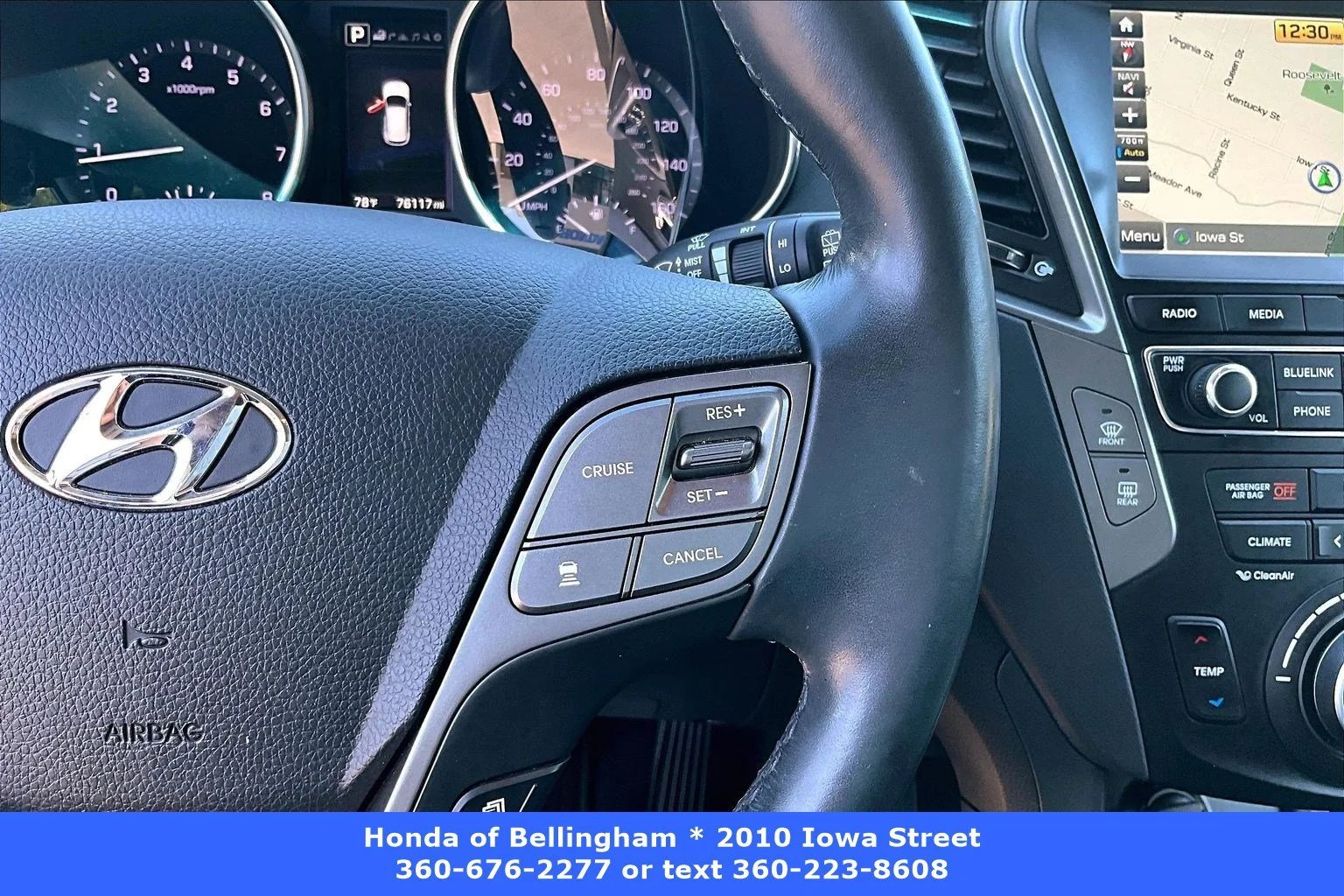 Used 2018 Mineral Gray Hyundai 2.0T Ultimate image 11