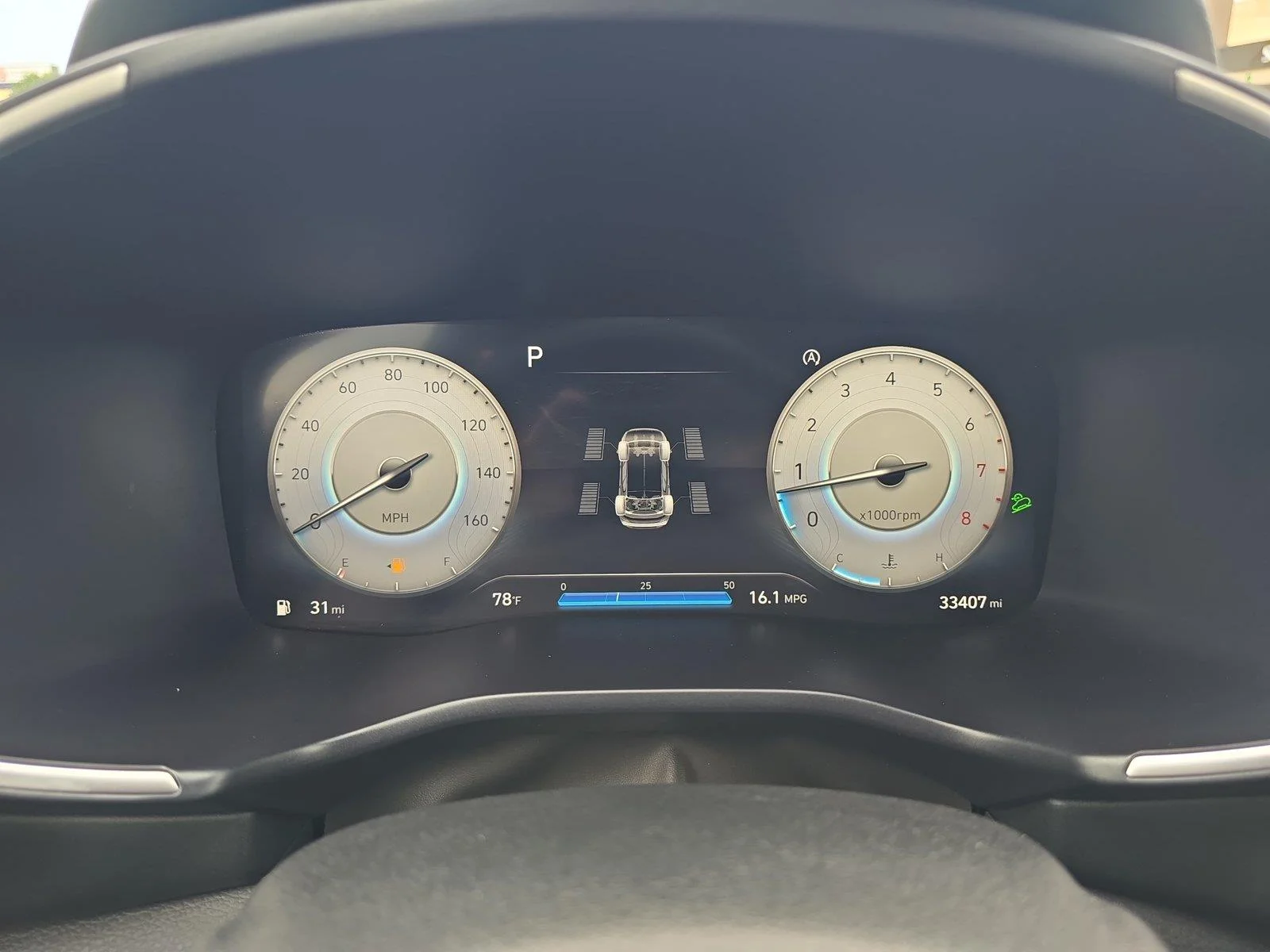 Used 2022 Twilight Black Hyundai XRT image 12