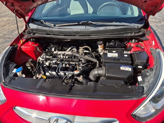 2017 Hyundai Accent SE - Photo 28