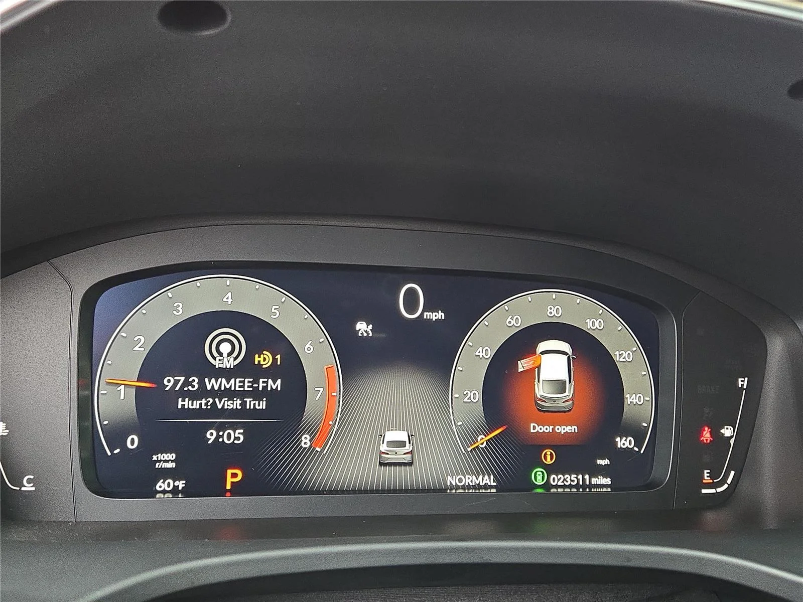 Certified Used 2025 Majestic Black Pearl Acura A-SPEC TECH image 5